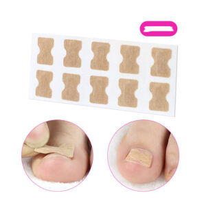 Glue-Free Orthopedic Nail Fixation Device