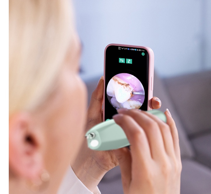 High-definition Visual Dental Cleaner 2 High-definition Visual Dental Cleaner - Image 2