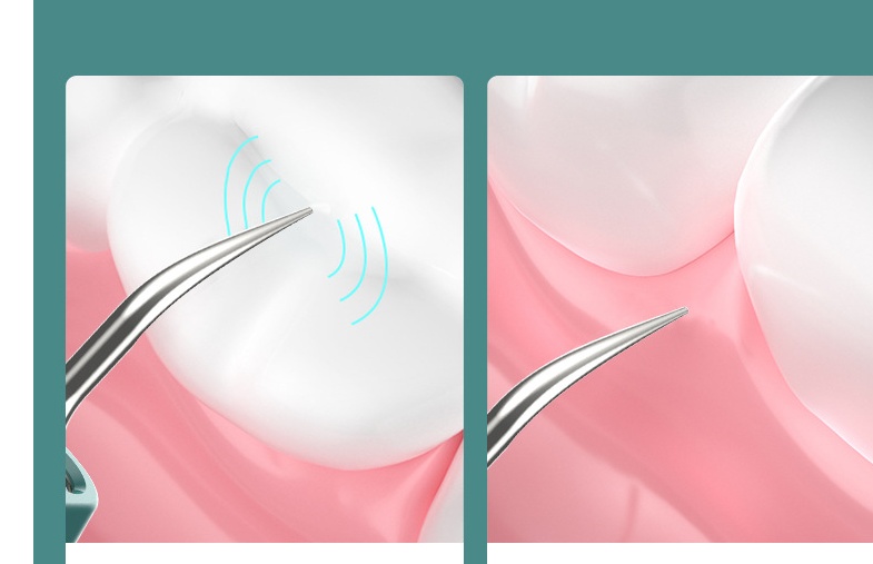 High-definition Visual Dental Cleaner 7 High-definition Visual Dental Cleaner - Image 7